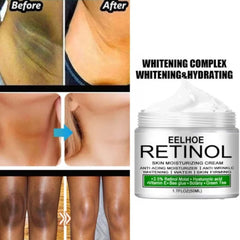 EELHOE Krema za Izbjeljivanje Kože za Svježi i Blistavi Ton