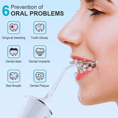 Električni Oralni Irigator - Napredni Vodeni Čistač za Svježe i Zdravo Osoblje