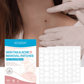 Efikasni flasteri za brzo i sigurno uklanjanje bradavica