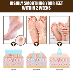 Hidratantna Krema za Ispucalu i Oštećenu Kožu