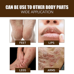 Hidratantna Krema za Ispucalu i Oštećenu Kožu