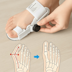 Profesionalni ispravljač Korektor za Nožne Prste