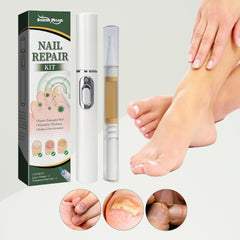 Revolucionarna uljana olovka za borbu protiv gljivica na noktima